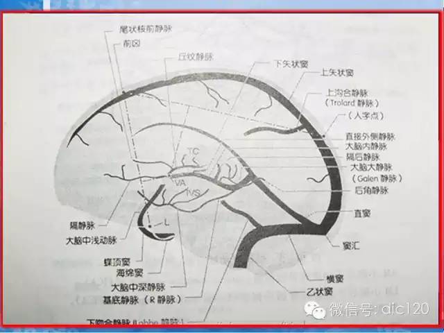 头颅静脉及静脉窦解剖图片