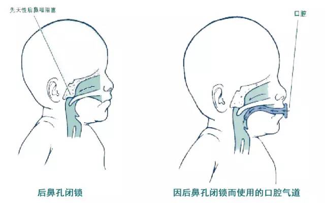 后鼻孔圆枕图片