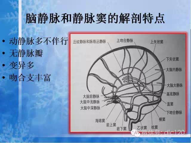 大脑大静脉池图片