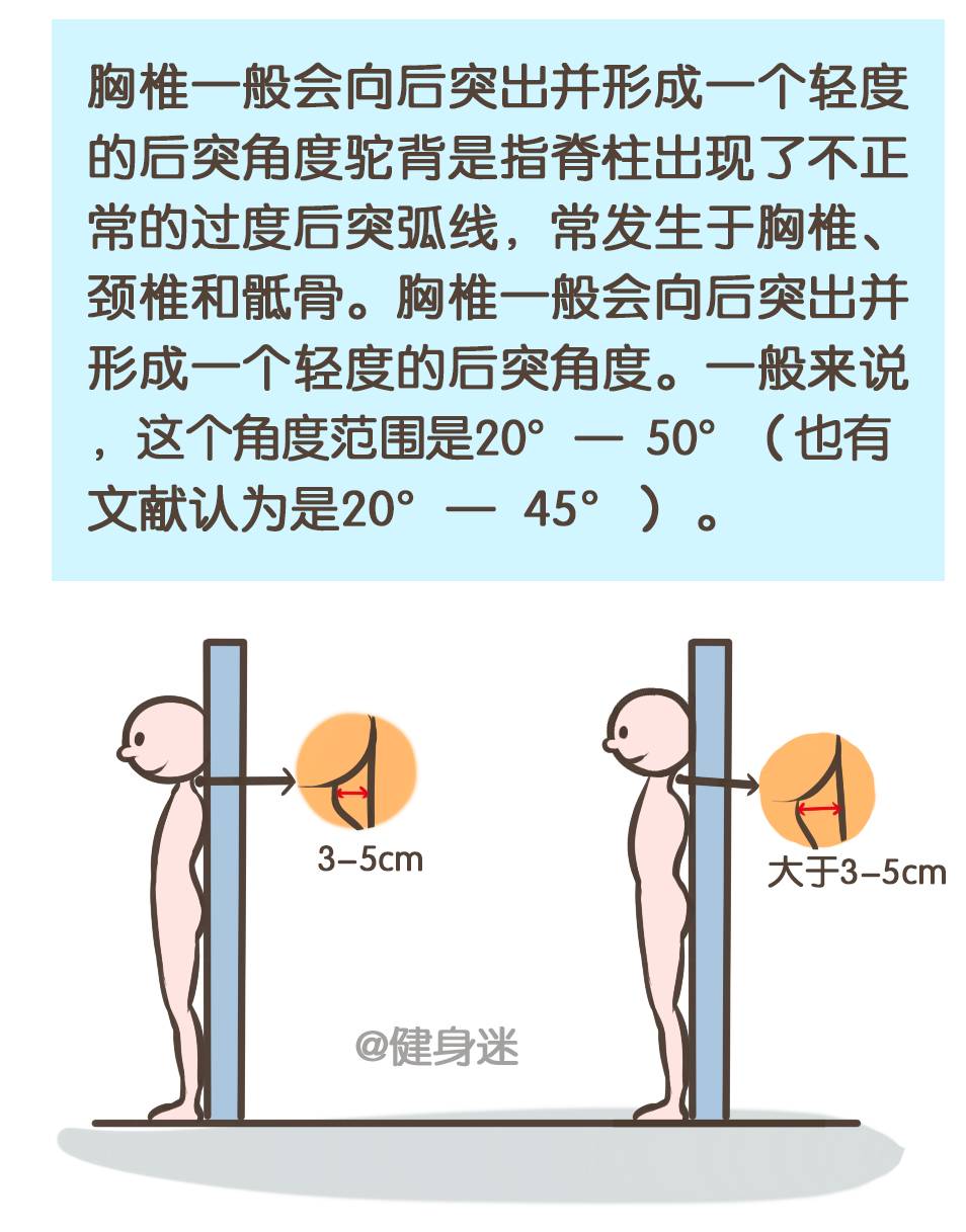 怎样纠正成年人驼背,耸肩的体态?