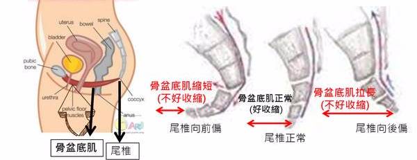 自從尾椎撞到後,為何整個人就不對勁了呢?