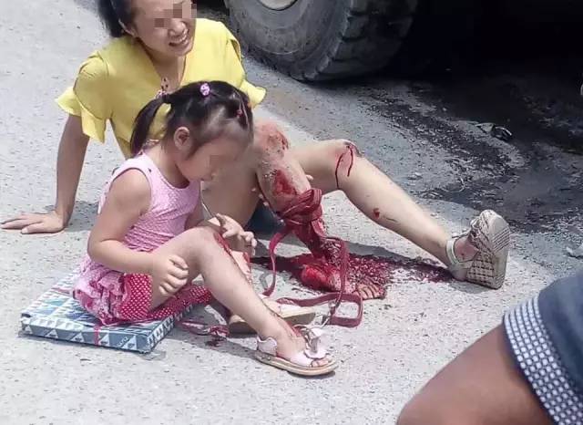 脸上表情痛苦不堪,其中一名坐在黄衣女子旁边的小女孩膝盖被磕破,血水