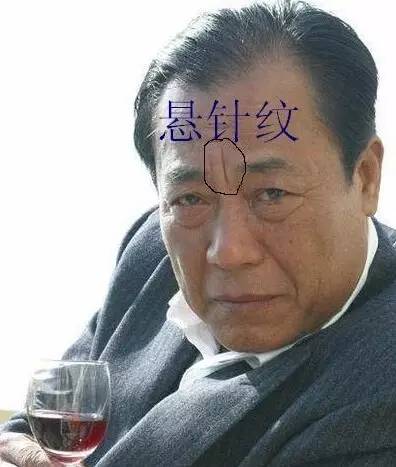 印堂发黑通常是有不好的事情发生,人在倒霉的时候也是应堂发黑