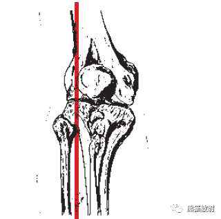 解剖膝關節mri冠矢狀雙語