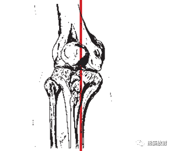 向後)proximal 近側的distal 遠側的medial 外側的lateral 內側的1 外