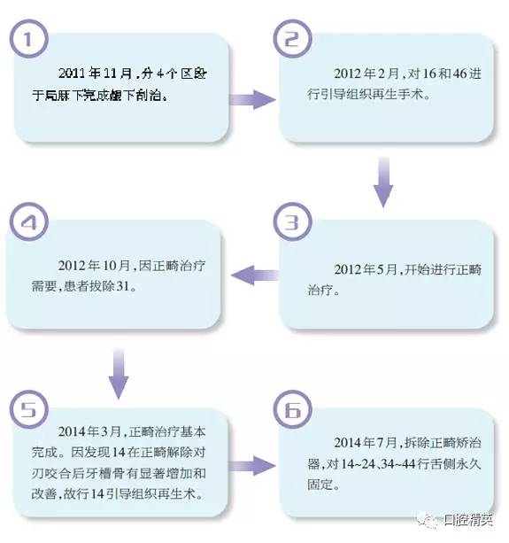 本病例是一個典型的廣泛型侵襲性牙周炎病例,患者病變範圍廣,附著喪失