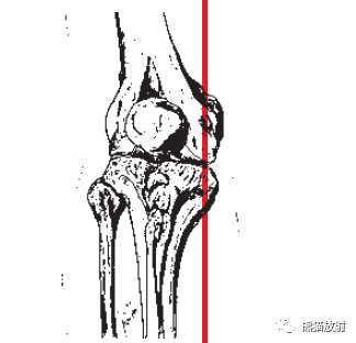 向後)proximal 近側的distal 遠側的medial 外側的lateral 內側的1 外