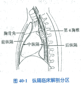 第二節 縱膈腫瘤好發部位一,前縱膈:畸胎瘤和囊腫,胸腺瘤,胸內甲狀腺