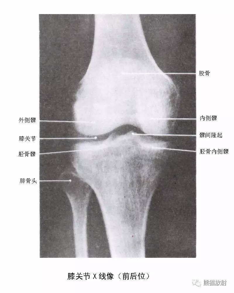 解剖膝关节系统解剖图矢状mri示意图