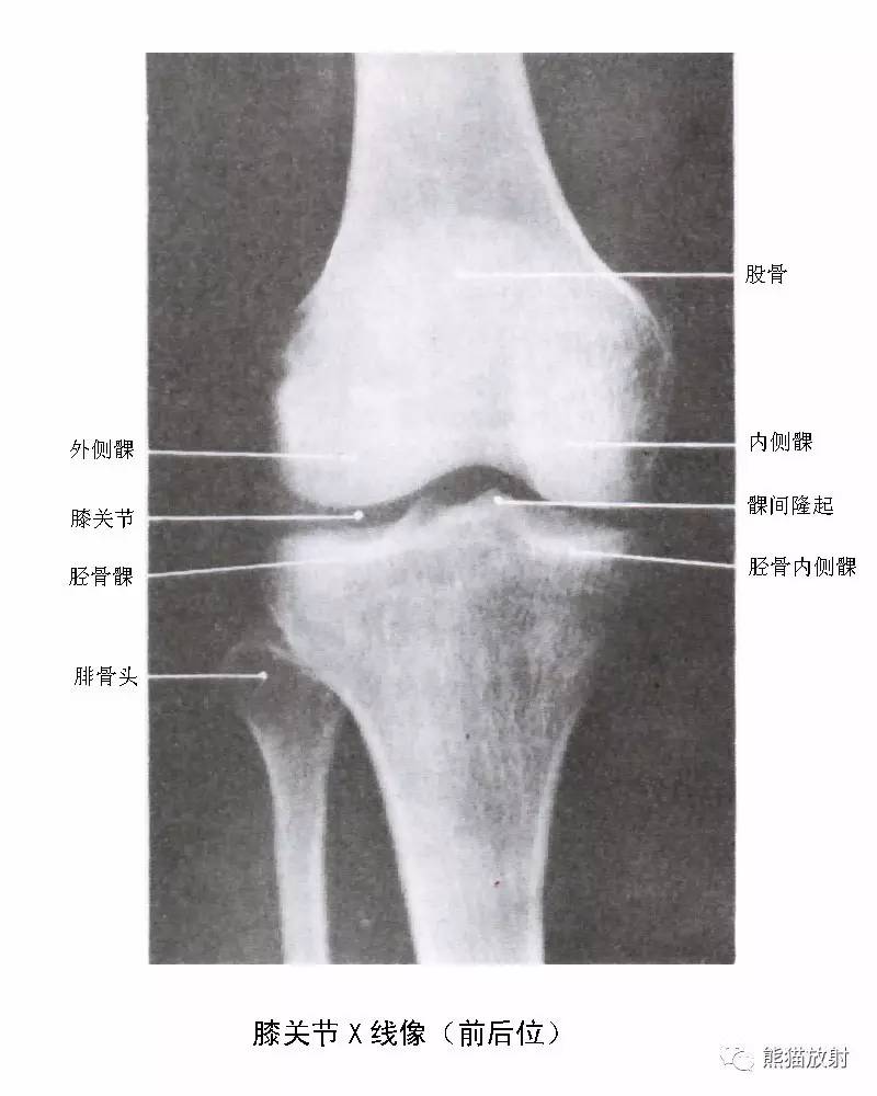 膝关节侧位解剖图片