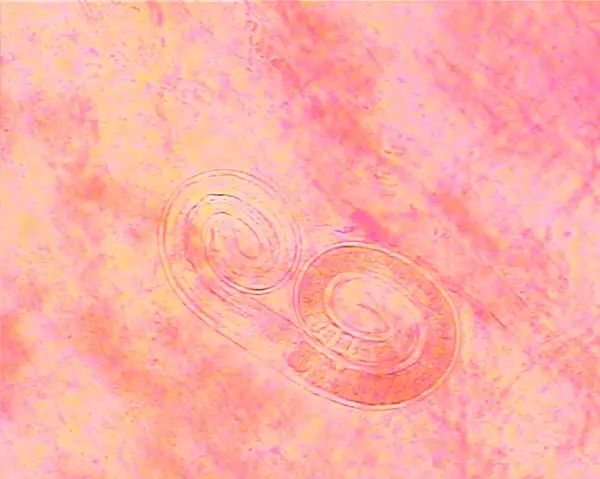 旋毛虫囊包显微镜图图片
