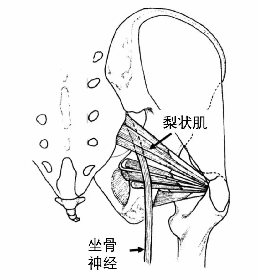 臀肌手绘图图片