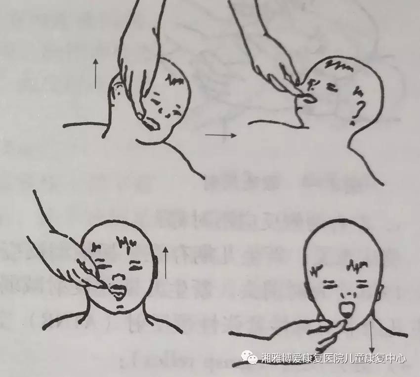 存在时期:0—4个月临床意义:正常足月新生儿脸颊部接触到母亲乳房或