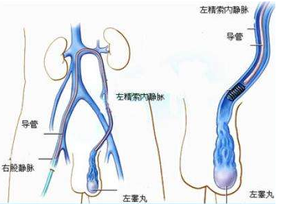 睾丸萎缩到底是什么鬼!