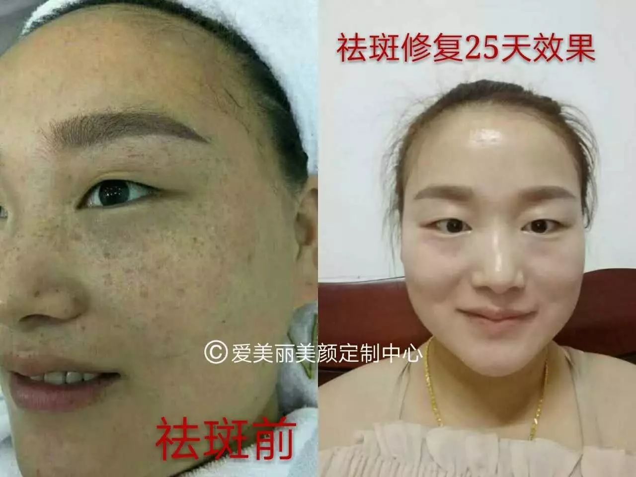 美容祛斑哪家好,南丰国安爱美丽