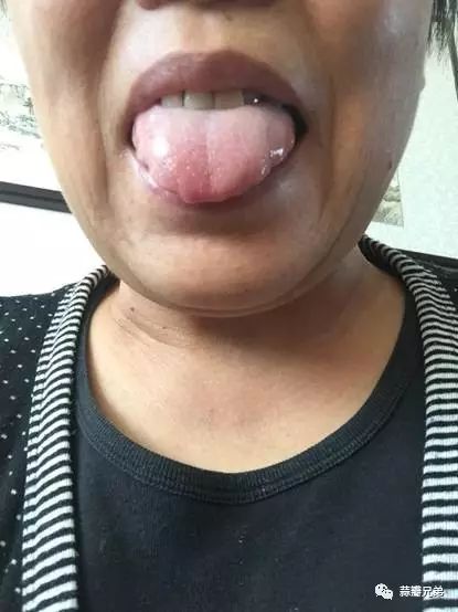 舌像图片本人,51,黑龙江省