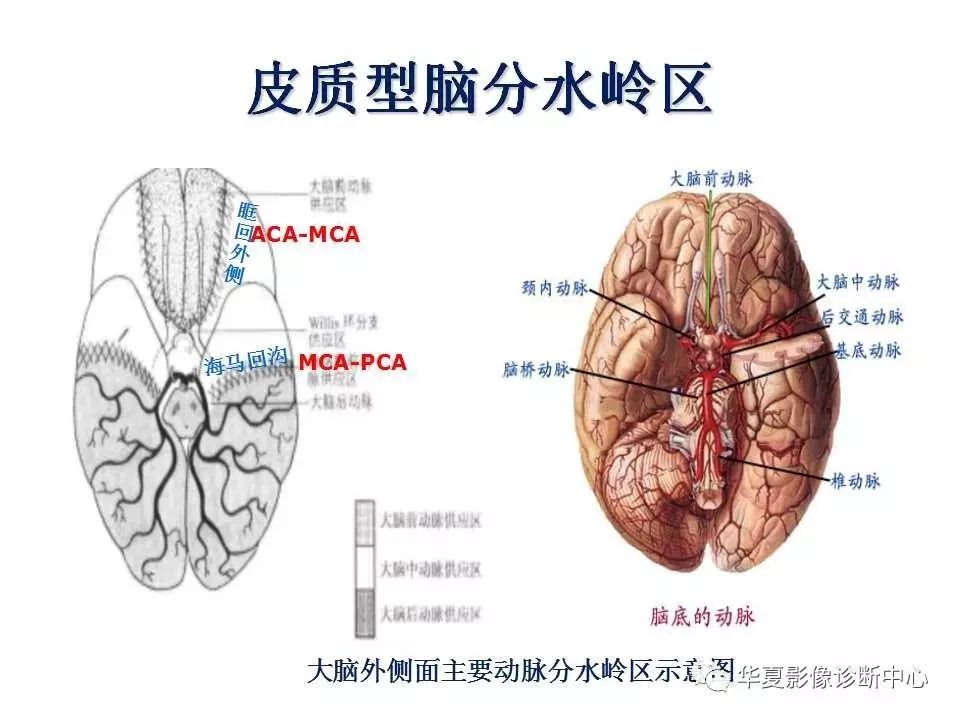 大脑分水岭区图片