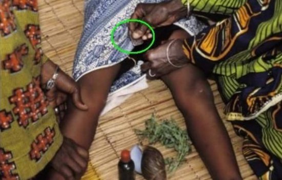 女性的噩梦非洲可怕的割礼习俗