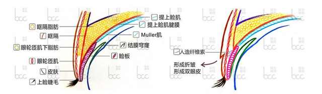 免费做双眼皮手术会失败吗