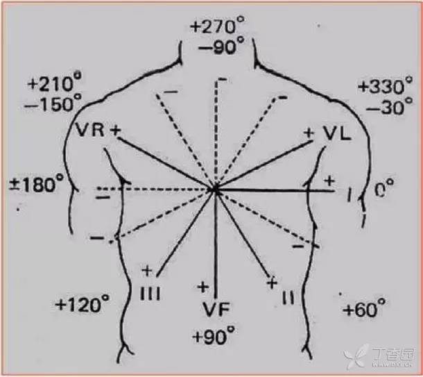心电图横面六轴系统图片