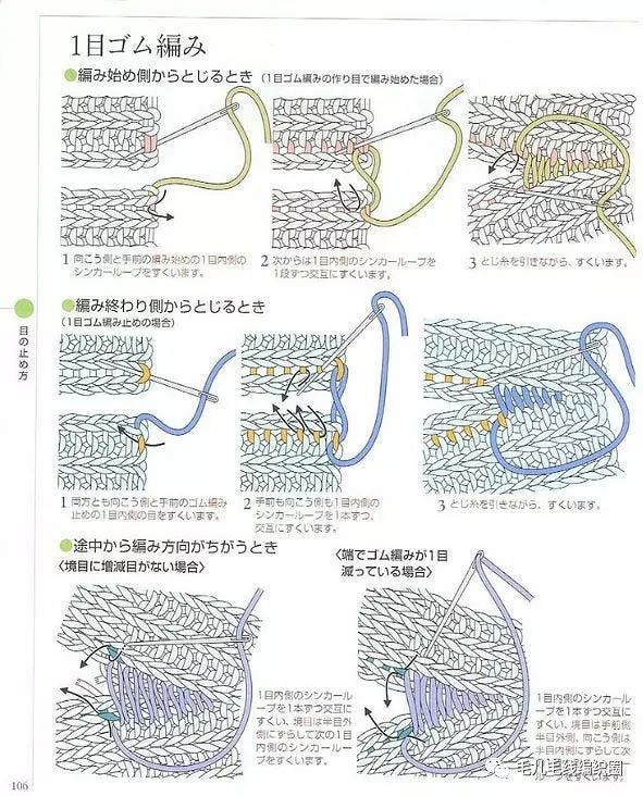 海曼缝合术图片