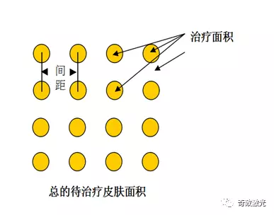 剥离激光点阵