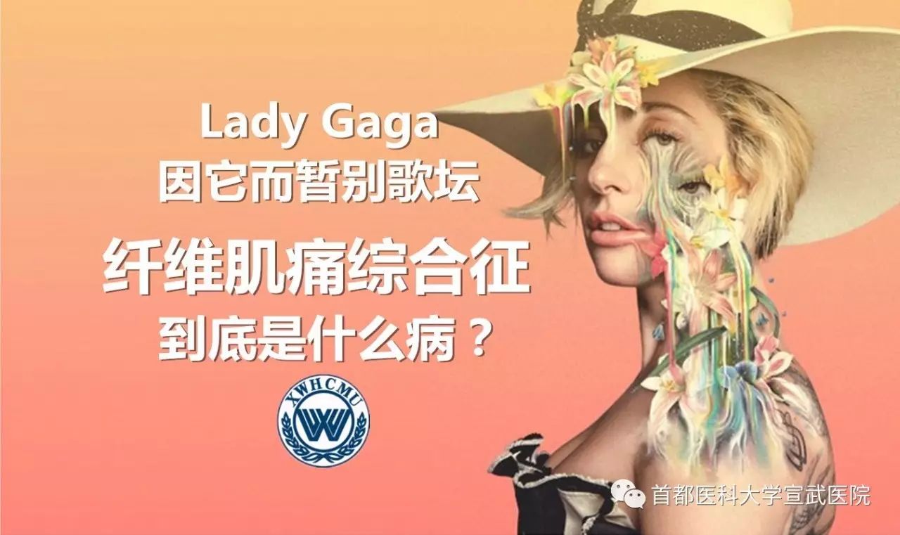 宣醫科普ladygaga因它而暫別歌壇纖維肌痛綜合徵到底是什麼病