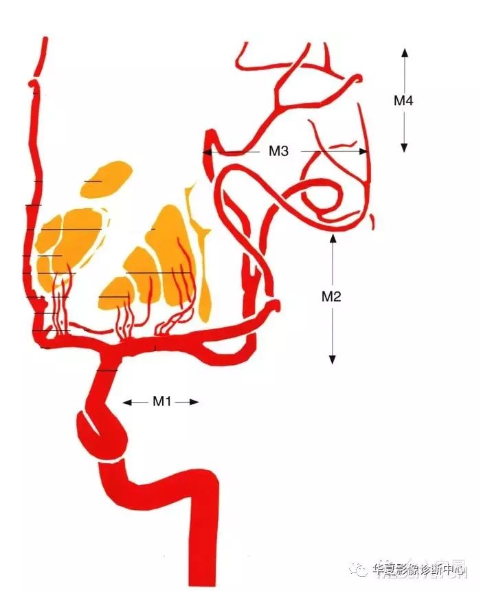 脑内动脉分段解剖图图片