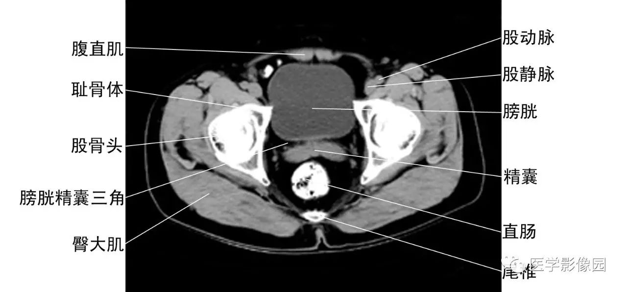 前列腺层面)肾脏ct影像见第六章腹部第一节检查方法与正常解剖正常