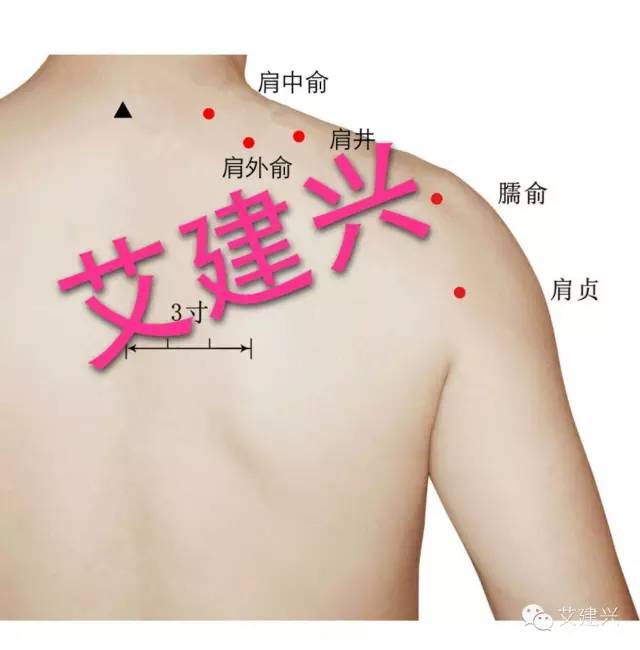 治疗乳腺增生艾灸图图片