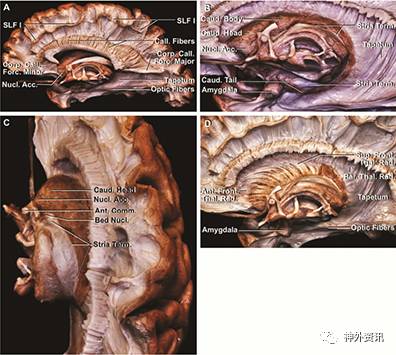 大腦半球內側面及底面的纖維束解剖