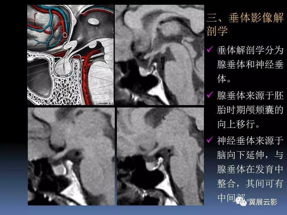 鞍区解剖图MRI图片