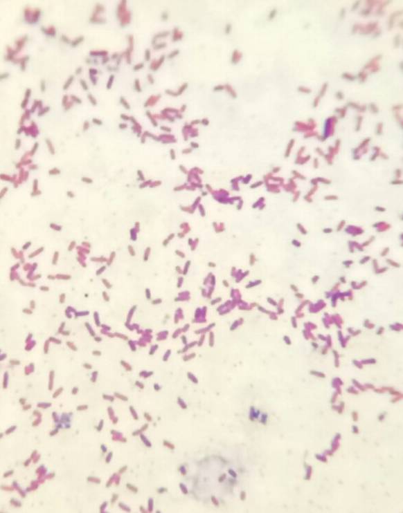 大肠杆菌抑菌圈图片
