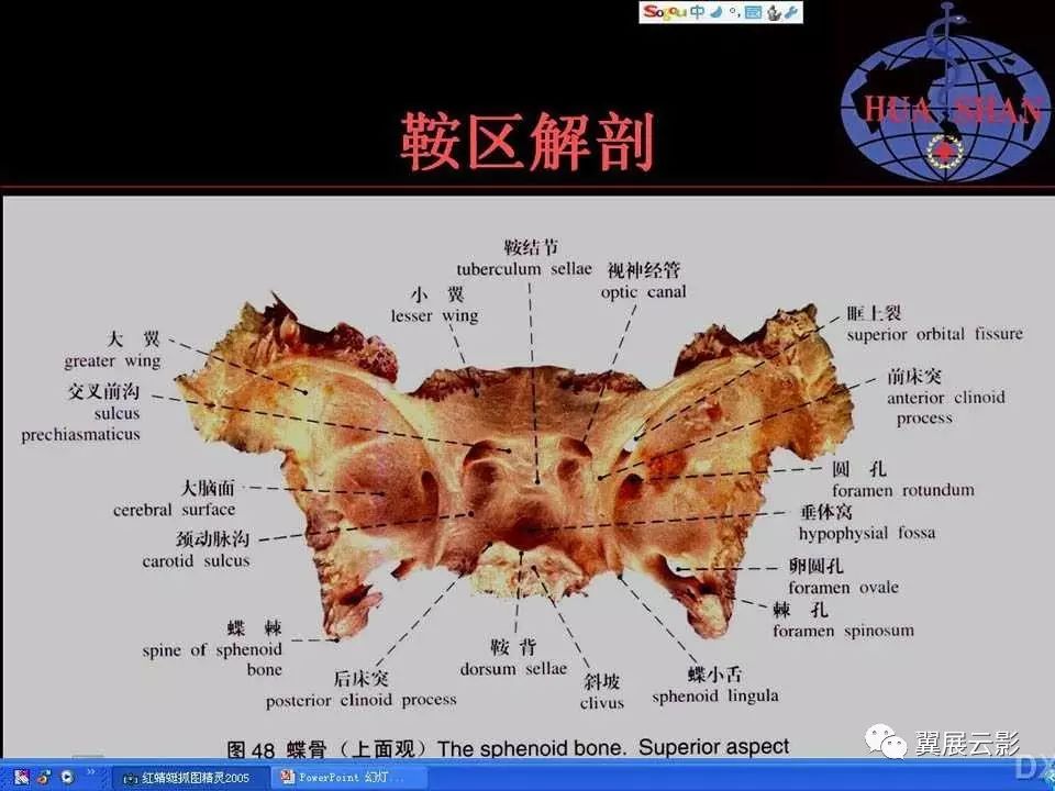 鞍区病变影像诊断