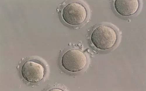 目前,光镜下卵母细胞形态的观察仍是临床上最常用的评估和选择卵母