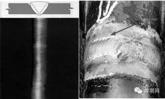 焊工必须知道的rt探伤时焊缝常见缺陷图谱