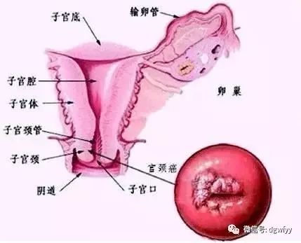 子宫颈解剖图及解释图片