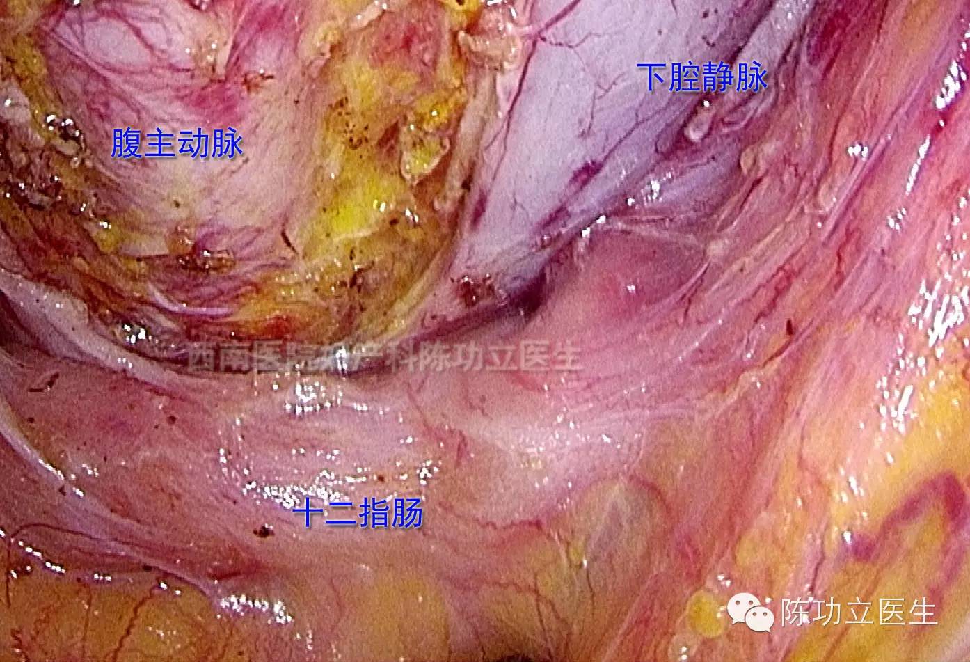 收藏!婦產科手術解剖圖譜之血管解剖