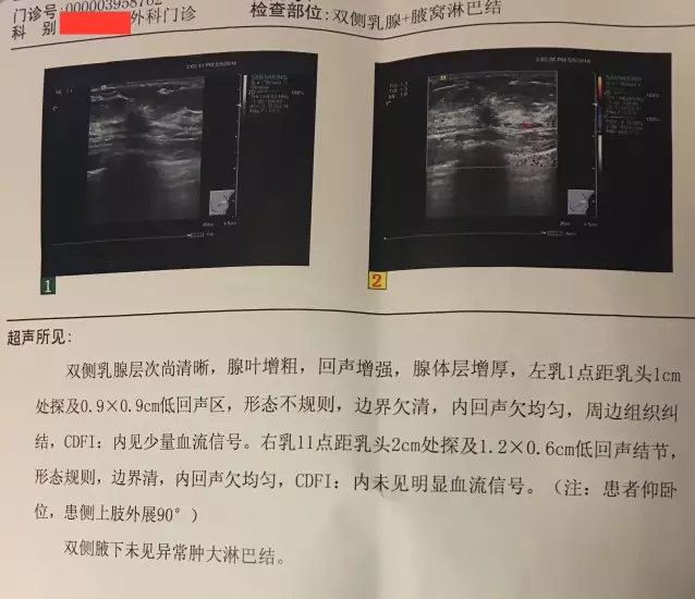 28歲就得了乳腺癌年輕媽媽的健康查體很重要