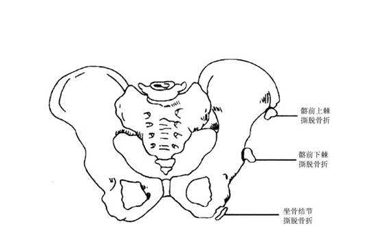 骨盆图片结构图简笔画图片