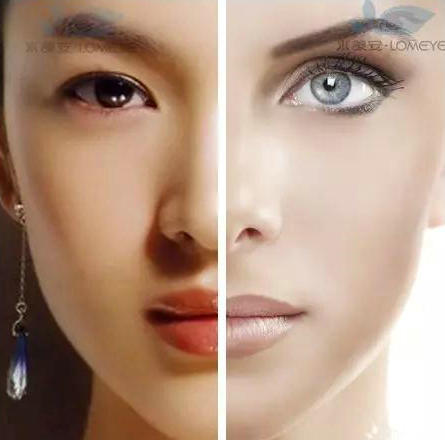 《爱丽头条》为什么亚洲人比欧洲人看起来更年轻?黑龙江美容仪器厂家
