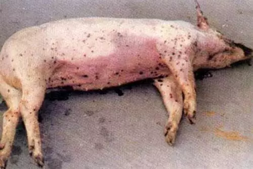 猪带绦虫患者图片