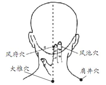 这样刮痧