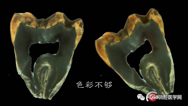 牙体组织纵断磨片绘图图片