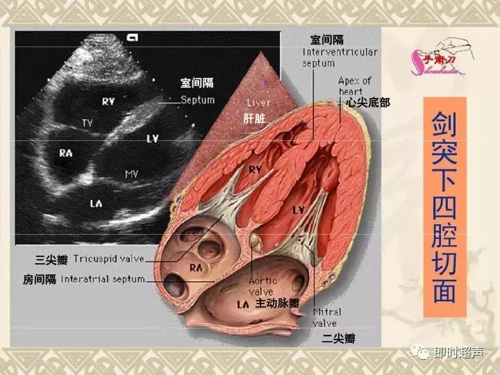 超声心动图常用切面的打法图解