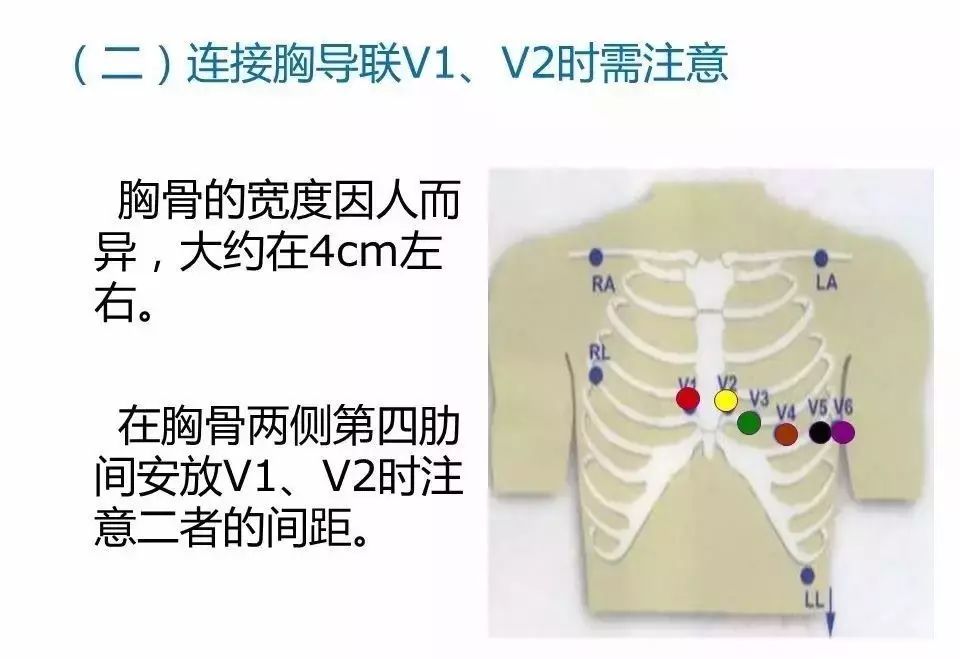 十八导心电图颜色位置图片