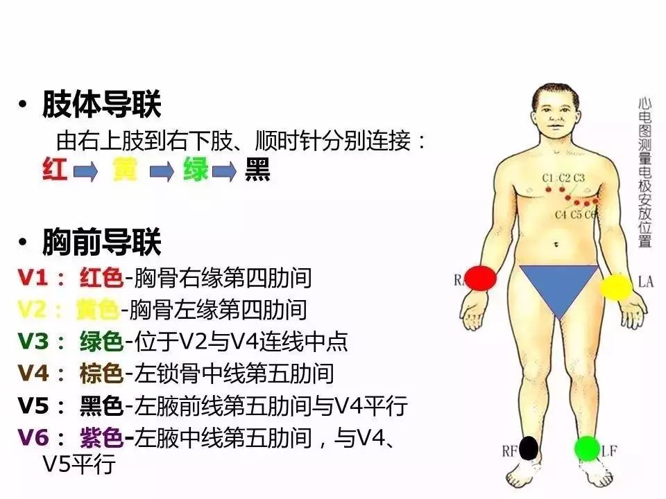 十八导心电图颜色位置图片