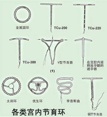 宫内节育环种类图片