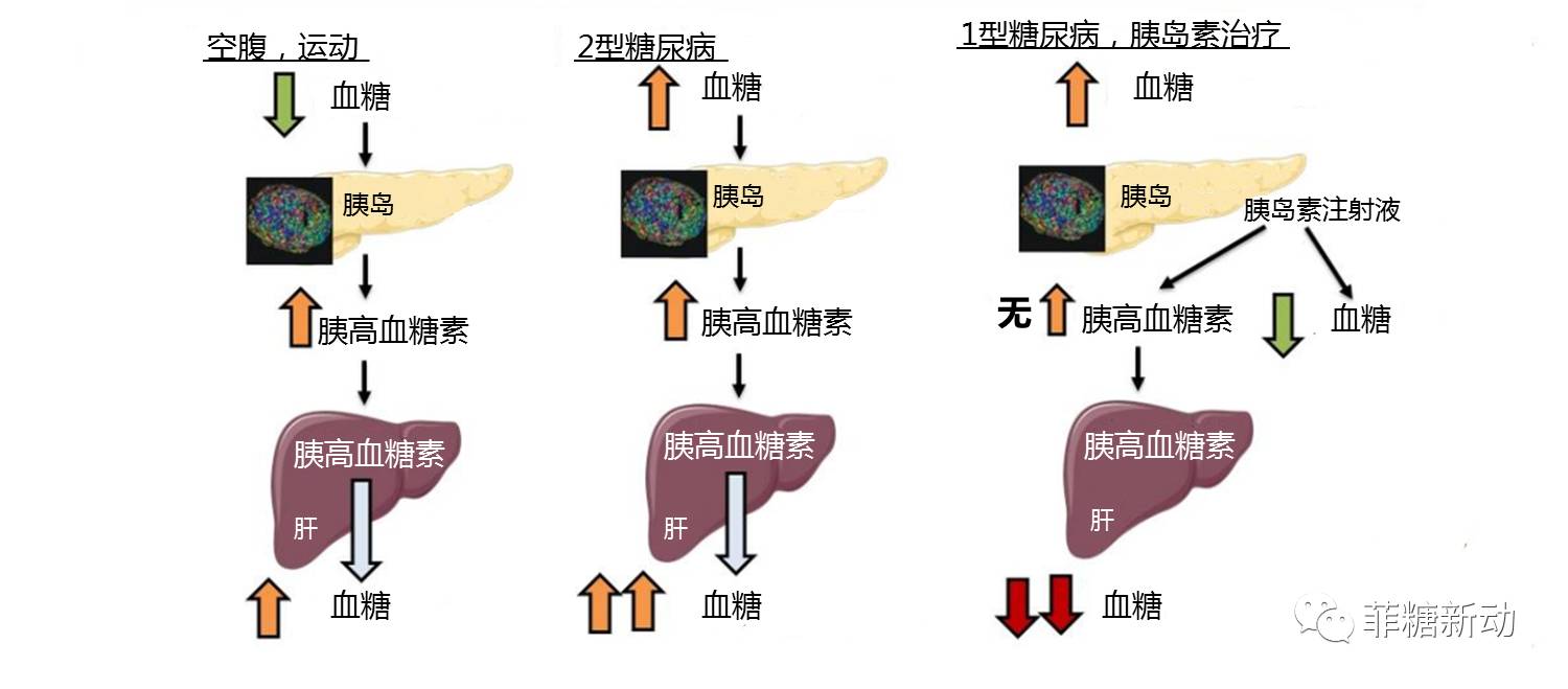 胰高血糖素负反馈调节受损胰岛α细胞主要功能包括①通过调节胰高