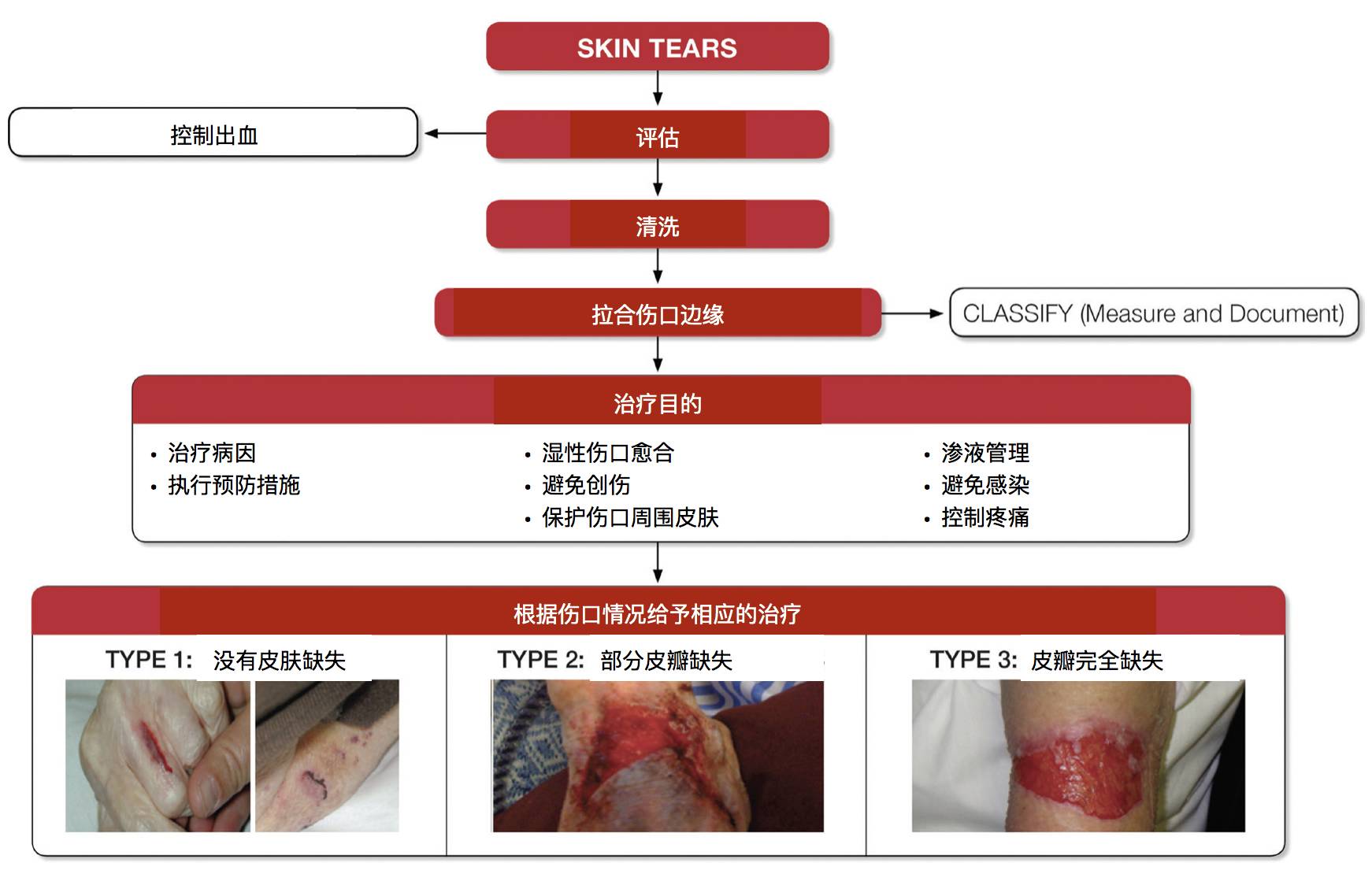 皮肤逆行撕脱伤示意图图片